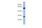 Guanylyl Cyclase Domain Containing 1 antibody, PA5-46258, Invitrogen Antibodies, Western Blot image 