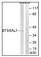 ST6 Beta-Galactoside Alpha-2,6-Sialyltransferase 1 antibody, AP31619PU-N, Origene, Western Blot image 