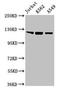 Toll Like Receptor 7 antibody, LS-C285630, Lifespan Biosciences, Western Blot image 