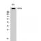 Acetyl-CoA Carboxylase Alpha antibody, LS-C381880, Lifespan Biosciences, Western Blot image 