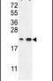 Abhydrolase Domain Containing 14B antibody, PA5-26705, Invitrogen Antibodies, Western Blot image 