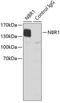 NBR1 Autophagy Cargo Receptor antibody, 19-224, ProSci, Immunoprecipitation image 