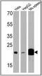 Prostaglandin E Synthase 3 antibody, GTX22814, GeneTex, Western Blot image 
