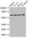 RCC1 And BTB Domain Containing Protein 2 antibody, orb25544, Biorbyt, Western Blot image 