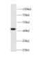 Hydroxyacid Oxidase 1 antibody, FNab03752, FineTest, Western Blot image 