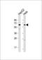 EH Domain Containing 1 antibody, GTX53560, GeneTex, Western Blot image 