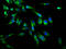 Plexin B1 antibody, LS-C671471, Lifespan Biosciences, Immunofluorescence image 