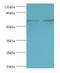 Interleukin-27 receptor subunit alpha antibody, MBS1493616, MyBioSource, Western Blot image 