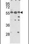 Protein Interacting With PRKCA 1 antibody, PA5-13841, Invitrogen Antibodies, Western Blot image 