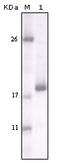Discoidin Domain Receptor Tyrosine Kinase 2 antibody, 32-144, ProSci, Enzyme Linked Immunosorbent Assay image 