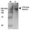 Notch Receptor 1 antibody, 56544, QED Bioscience, Western Blot image 