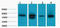 Lactate Dehydrogenase D antibody, A11154, Boster Biological Technology, Western Blot image 