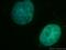 Distal-Less Homeobox 4 antibody, 12084-1-AP, Proteintech Group, Immunofluorescence image 