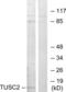 Tumor suppressor candidate 2 antibody, LS-B9915, Lifespan Biosciences, Western Blot image 