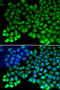 Replication Protein A1 antibody, STJ25385, St John