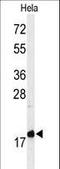 Membrane Magnesium Transporter 1 antibody, LS-C164231, Lifespan Biosciences, Western Blot image 