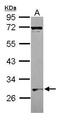 WD Repeat And SOCS Box Containing 1 antibody, PA5-30504, Invitrogen Antibodies, Western Blot image 