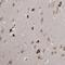 MLLT1 Super Elongation Complex Subunit antibody, NBP1-84840, Novus Biologicals, Immunohistochemistry frozen image 