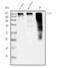 Sodium channel protein type 2 subunit alpha antibody, A01735-2, Boster Biological Technology, Western Blot image 