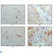 Crystallin Alpha B antibody, LS-C813967, Lifespan Biosciences, Western Blot image 