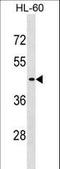 Eukaryotic Translation Initiation Factor 2B Subunit Gamma antibody, LS-C167682, Lifespan Biosciences, Western Blot image 