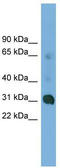 Coiled-Coil Domain Containing 127 antibody, TA340403, Origene, Western Blot image 