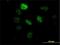 Splicing Factor 3b Subunit 2 antibody, H00010992-M01, Novus Biologicals, Immunofluorescence image 