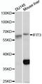 Interferon Induced Protein With Tetratricopeptide Repeats 3 antibody, LS-C748372, Lifespan Biosciences, Western Blot image 