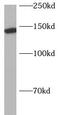 Adaptor Related Protein Complex 3 Subunit Beta 1 antibody, FNab00463, FineTest, Western Blot image 