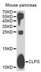 Colipase antibody, STJ28447, St John