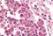 Cyclin Dependent Kinase 12 antibody, MBS243508, MyBioSource, Immunohistochemistry paraffin image 