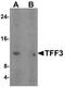 Trefoil Factor 3 antibody, A01738, Boster Biological Technology, Western Blot image 