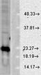 Superoxide Dismutase 1 antibody, orb67513, Biorbyt, Western Blot image 
