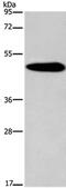 Potassium Voltage-Gated Channel Modifier Subfamily G Member 2 antibody, PA5-50690, Invitrogen Antibodies, Western Blot image 