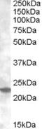 Solute Carrier Family 10 Member 2 antibody, 46-898, ProSci, Enzyme Linked Immunosorbent Assay image 