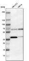 Chaperonin Containing TCP1 Subunit 3 antibody, PA5-52308, Invitrogen Antibodies, Western Blot image 