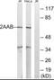 Protein Phosphatase 2 Scaffold Subunit Abeta antibody, PA5-39446, Invitrogen Antibodies, Western Blot image 