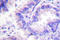 Protein Phosphatase 2 Catalytic Subunit Alpha antibody, LS-C176461, Lifespan Biosciences, Immunohistochemistry frozen image 