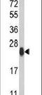 Autophagy Related 12 antibody, PA5-11271, Invitrogen Antibodies, Western Blot image 