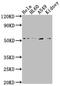 Integrin Linked Kinase antibody, CSB-RA963626A0HU, Cusabio, Western Blot image 