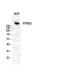 Protein Tyrosine Phosphatase Receptor Type Z1 antibody, A03510, Boster Biological Technology, Western Blot image 