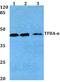 General Transcription Factor IIA Subunit 1 antibody, A09007-1, Boster Biological Technology, Western Blot image 