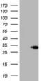 SIX Homeobox 1 antibody, NBP2-01606, Novus Biologicals, Western Blot image 