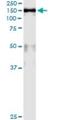 Minichromosome Maintenance Complex Component 2 antibody, H00004171-M01, Novus Biologicals, Immunoprecipitation image 