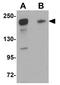 Signal Induced Proliferation Associated 1 Like 2 antibody, GTX85227, GeneTex, Western Blot image 