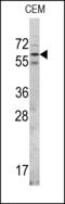 Serine/threonine-protein kinase RIO2 antibody, 62-587, ProSci, Western Blot image 