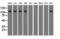Transforming Acidic Coiled-Coil Containing Protein 3 antibody, GTX83533, GeneTex, Western Blot image 