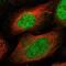 DBF4 Zinc Finger B antibody, NBP2-13900, Novus Biologicals, Immunofluorescence image 