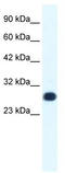 General Transcription Factor IIF Subunit 2 antibody, TA329284, Origene, Western Blot image 