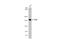 BLM RecQ Like Helicase antibody, GTX108868, GeneTex, Western Blot image 